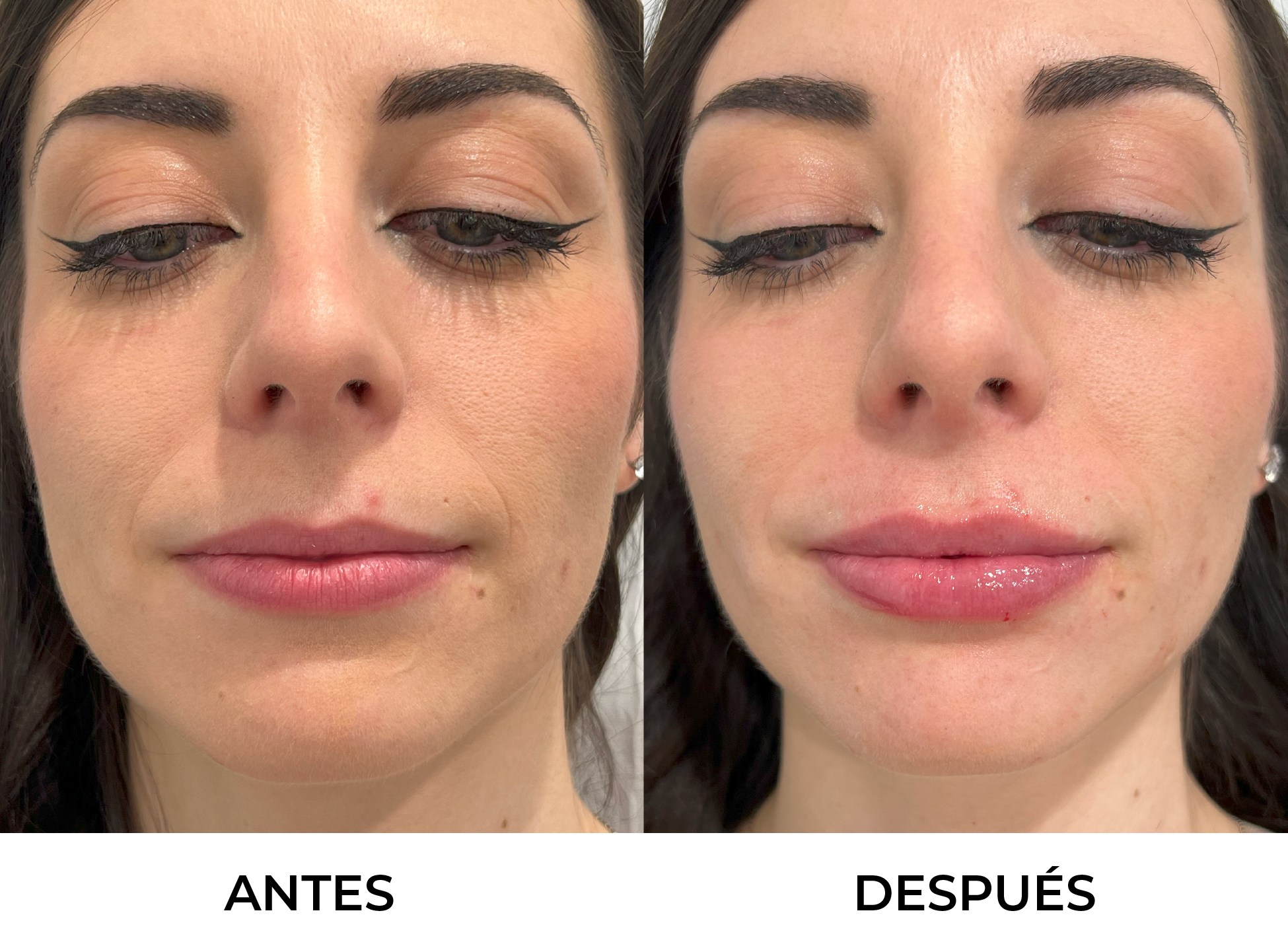 Antes y Después 13