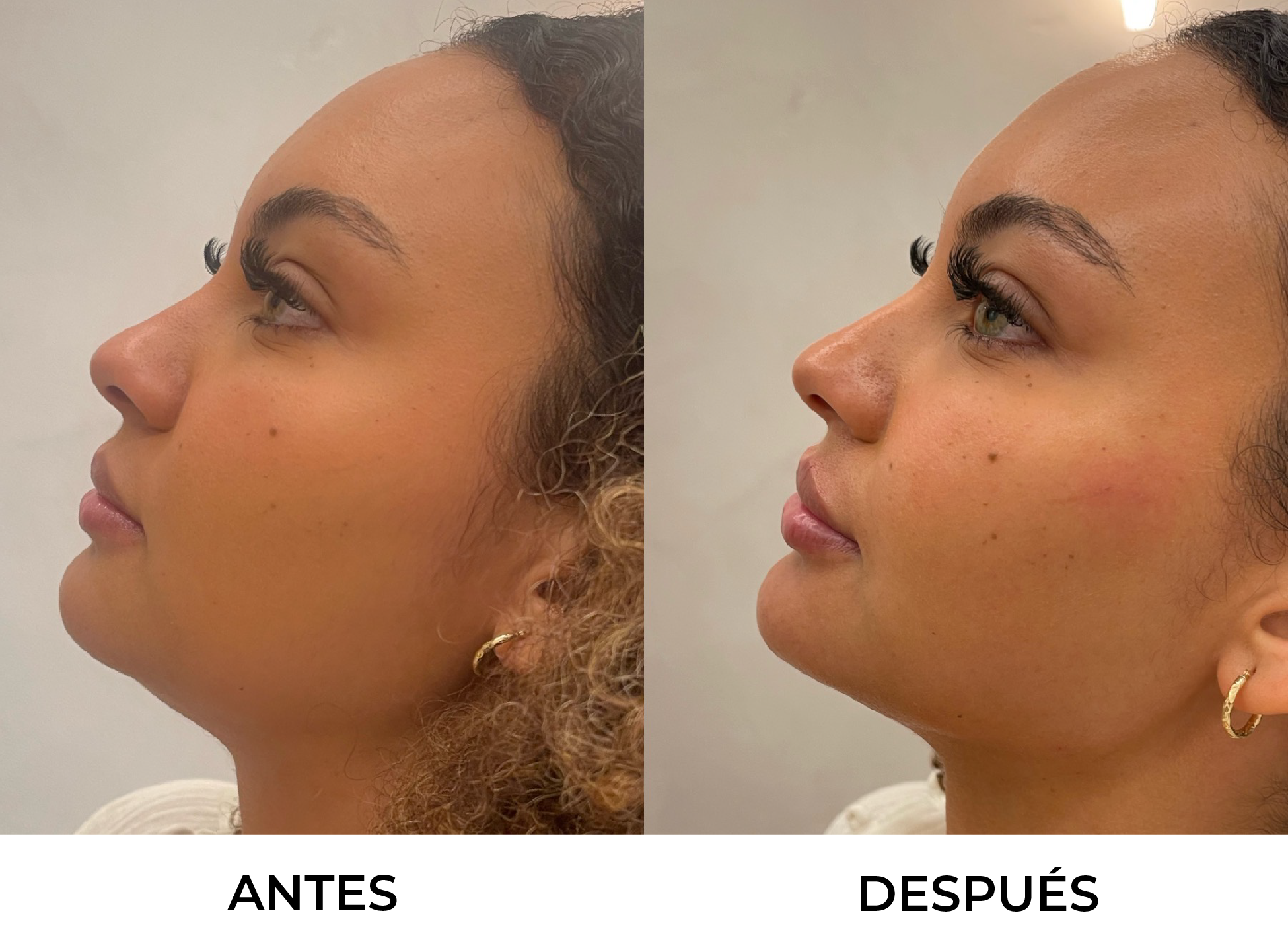 Antes y Después 3