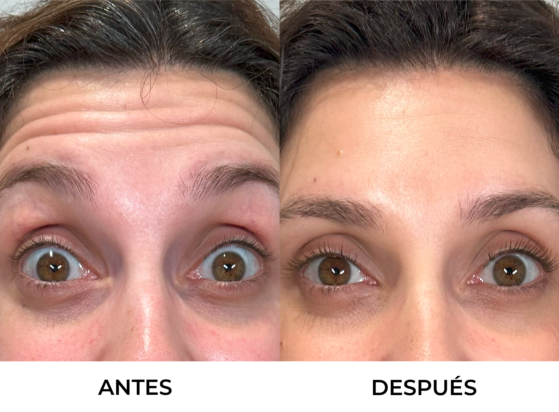 Líneas de Expresión