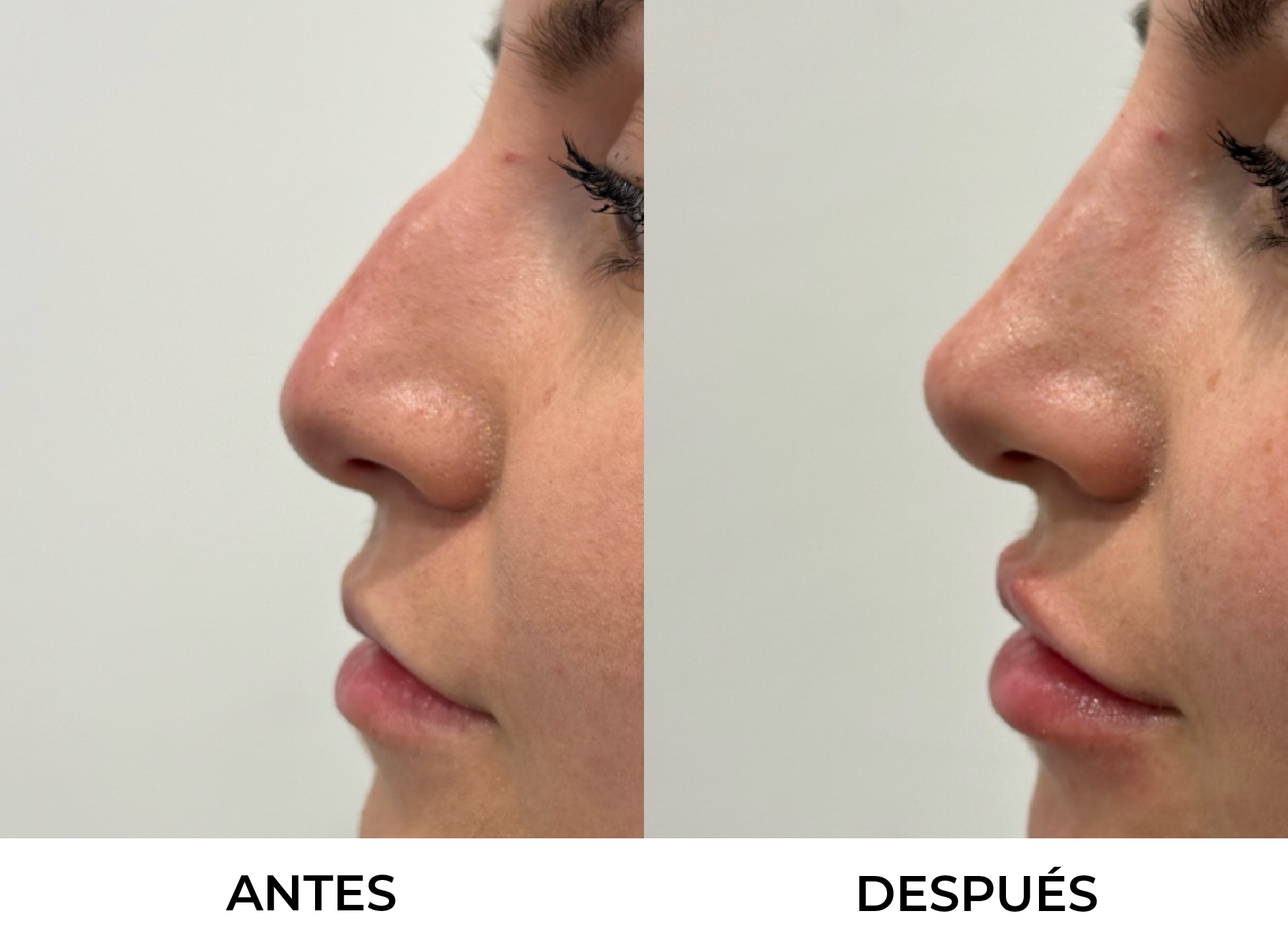 Antes y Después 3