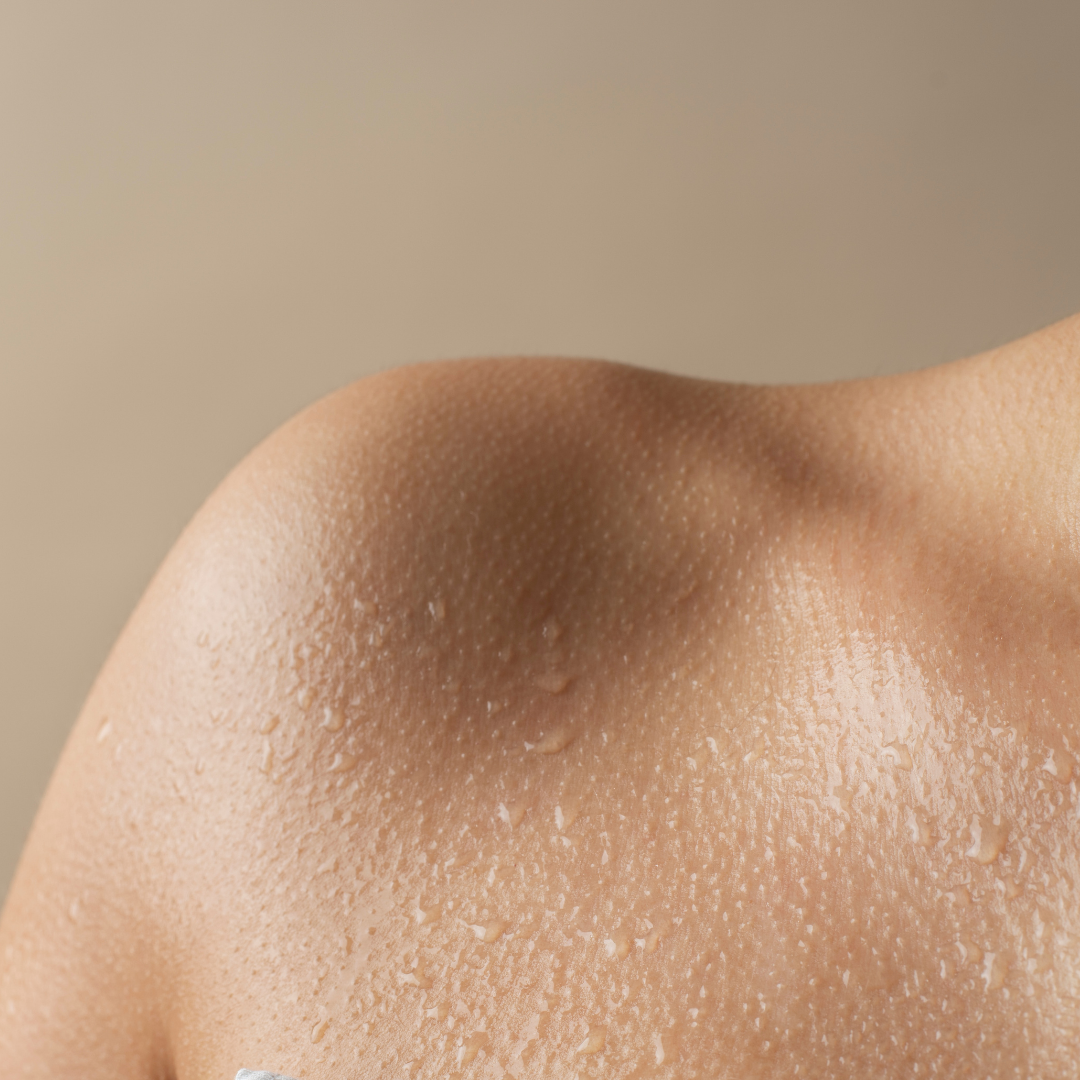 Hiperhidrosis Axilas/Palmar