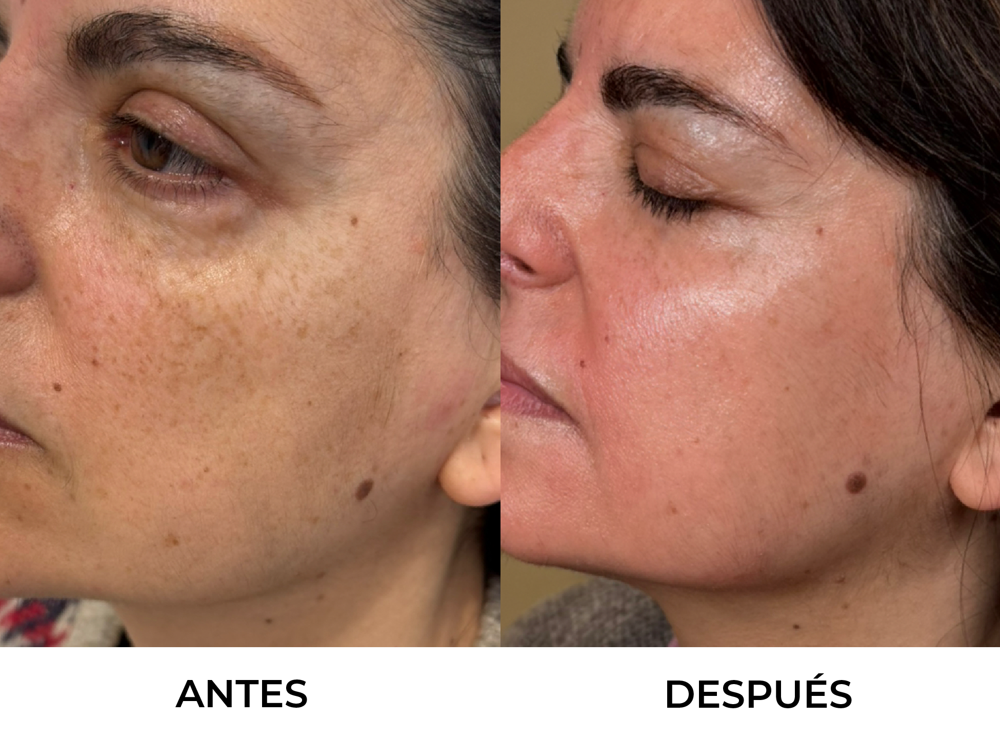 Antes y Después 1