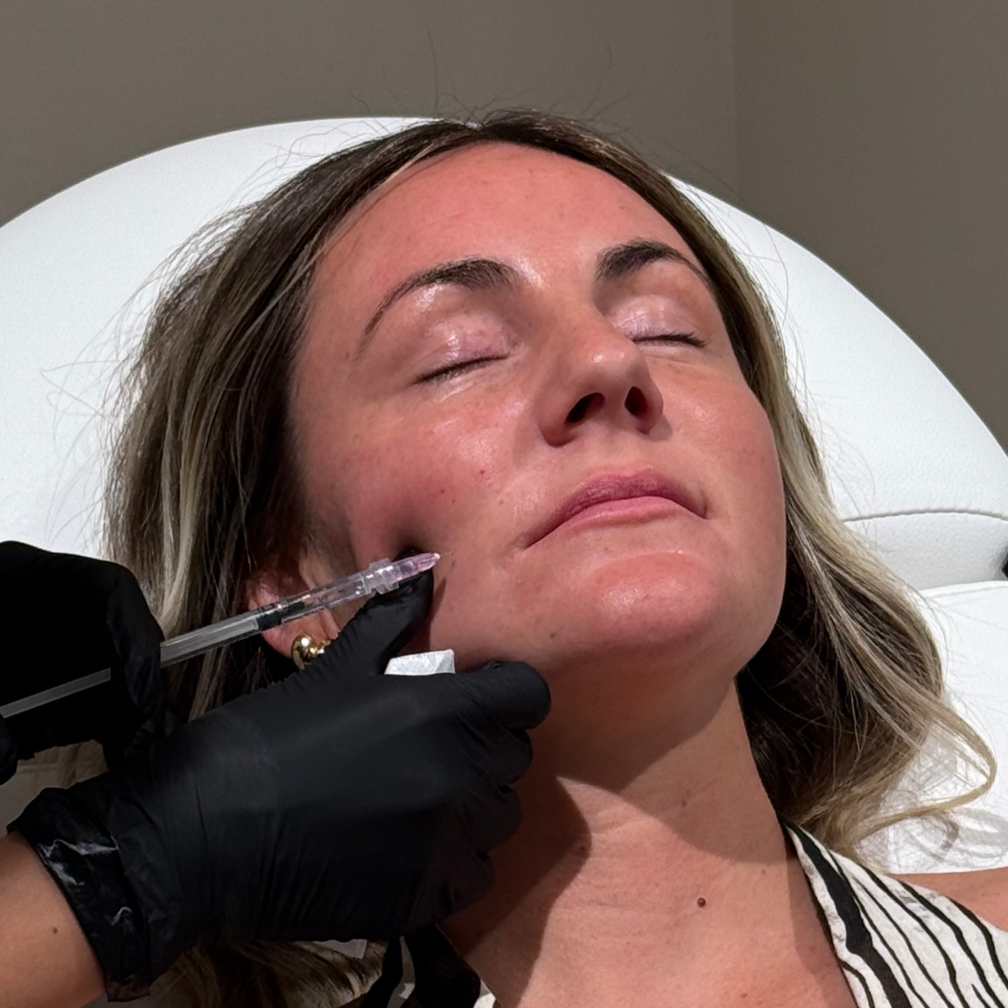 Inductores de Colágeno