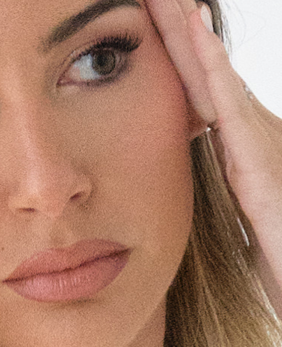 Rellenos de Fosa Temporal